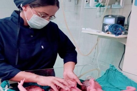 تولد سه قلوها از مادر ۲۴ ساله در رفسنجان