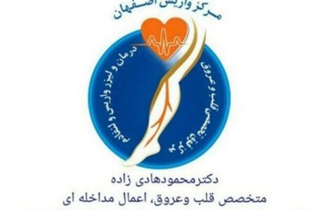 واریس و روش های درمان واریس