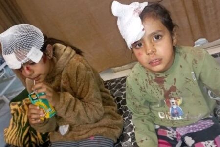 حمله سگ‌های ولگرد به دو دختربچه در کرمان