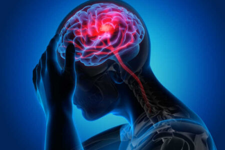 علائم اصلی سکته مغزی چیست؟/ تاثیر میگرن در این بیماری