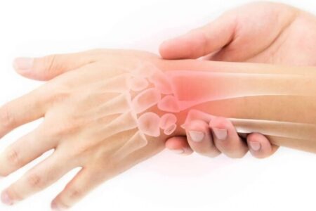 ساخت ایمپلنت برای کاهش درد مزمن بعد از شکستگی مچ دست