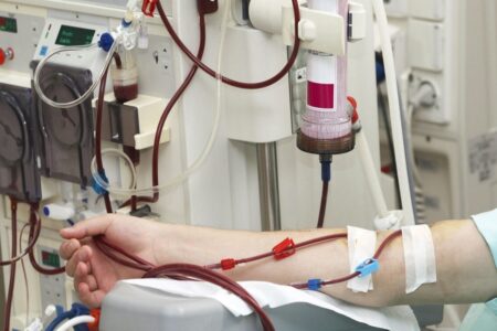 ابداع دستگاه دیالیز خون کامل بیماران سرطانی